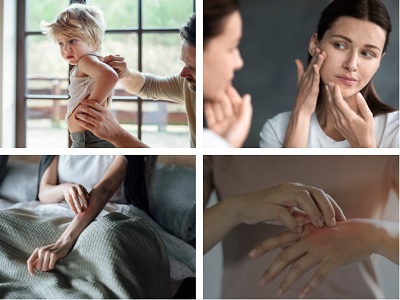 დერმატოლოგია