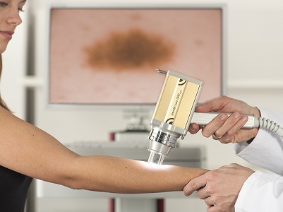 დერმოსკოპი